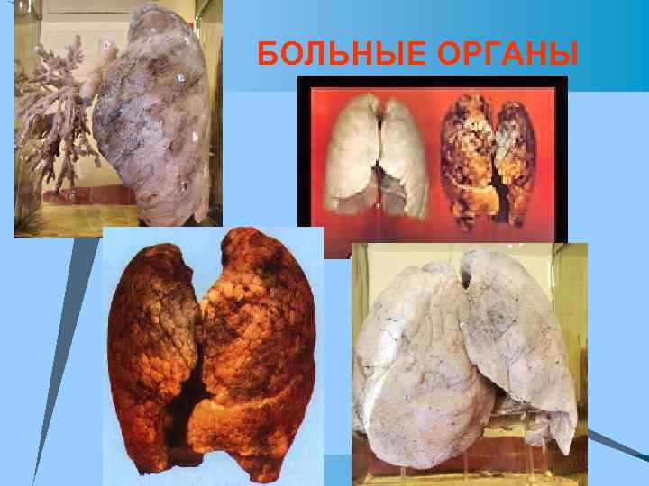 БОЛЬНЫЕ ОРГАНЫ 
