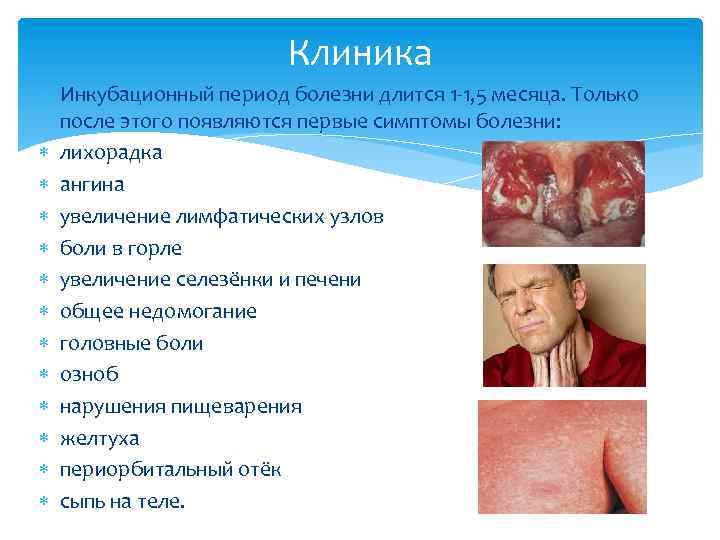 Клиника Инкубационный период болезни длится 1 -1, 5 месяца. Только после этого появляются первые