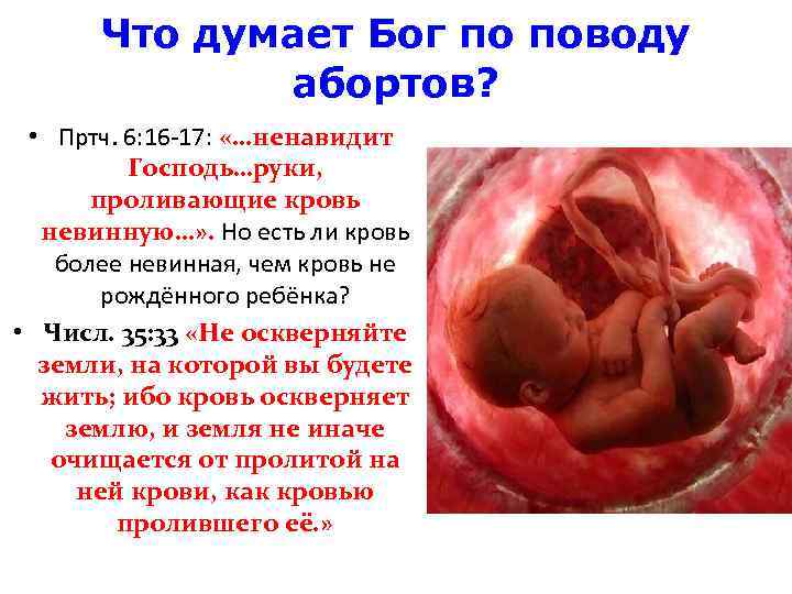 Что думает Бог по поводу абортов? • Пртч. 6: 16 -17: «…ненавидит Господь…руки, проливающие