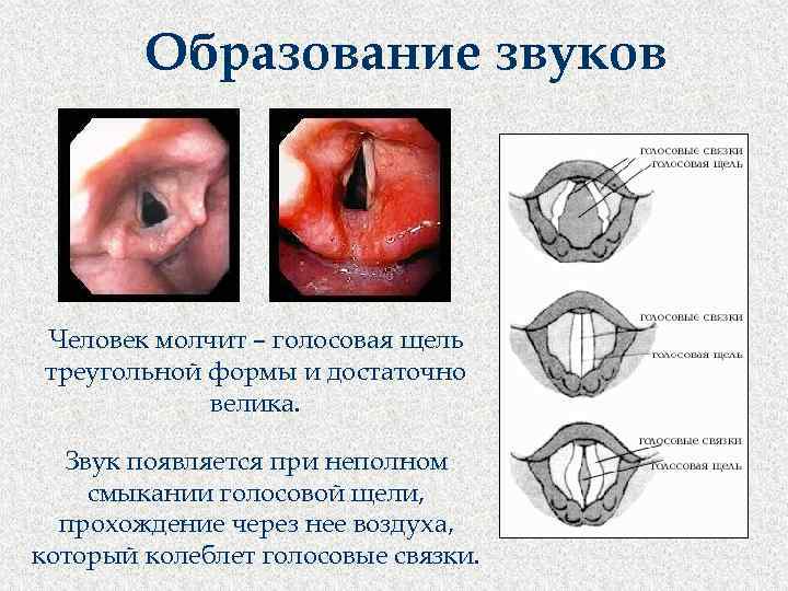 Образование звуков Человек молчит – голосовая щель треугольной формы и достаточно велика. Звук появляется