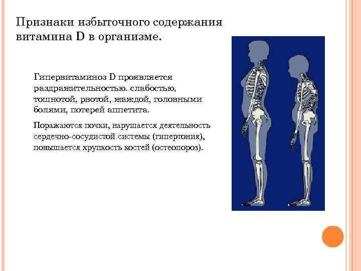 Признаки избыточного содержания витамина D в организме. Гипервитаминоз D проявляется раздражительностью. слабостью, тошнотой, рвотой,