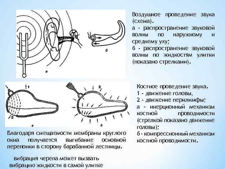 Воздушное проведение звука (схема). а - распространение звуковой волны по наружному и среднему уху;