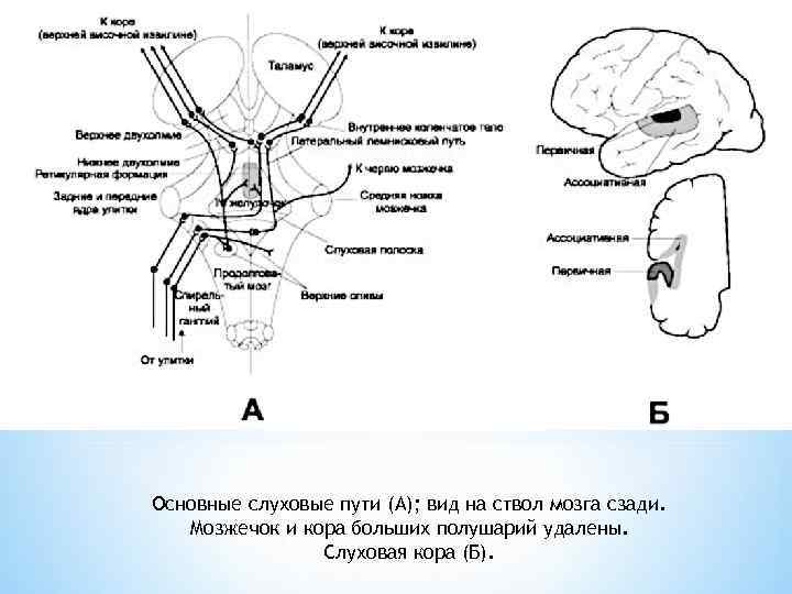 Основные слуховые пути (А); вид на ствол мозга сзади. Мозжечок и кора больших полушарий