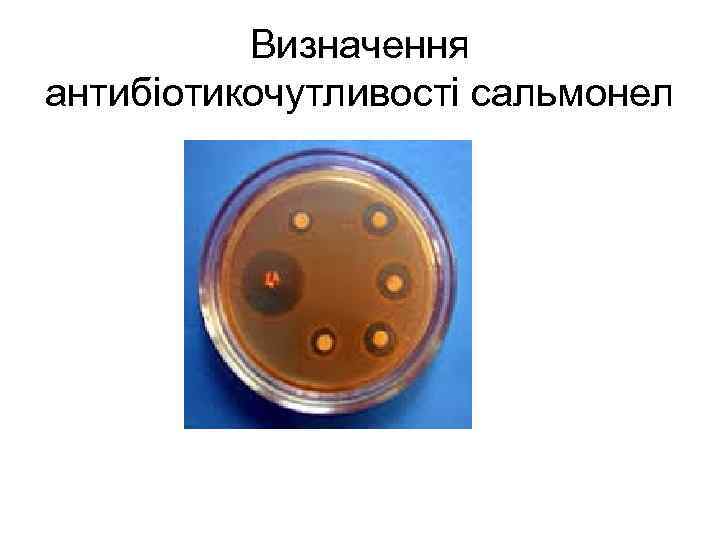 Визначення антибіотикочутливості сальмонел 