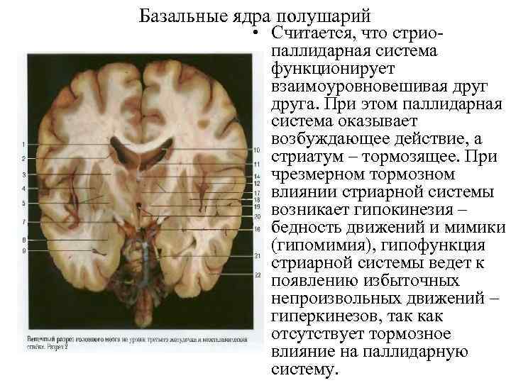 Базальные ядра полушарий • Считается, что стриопаллидарная система функционирует взаимоуровновешивая друга. При этом паллидарная