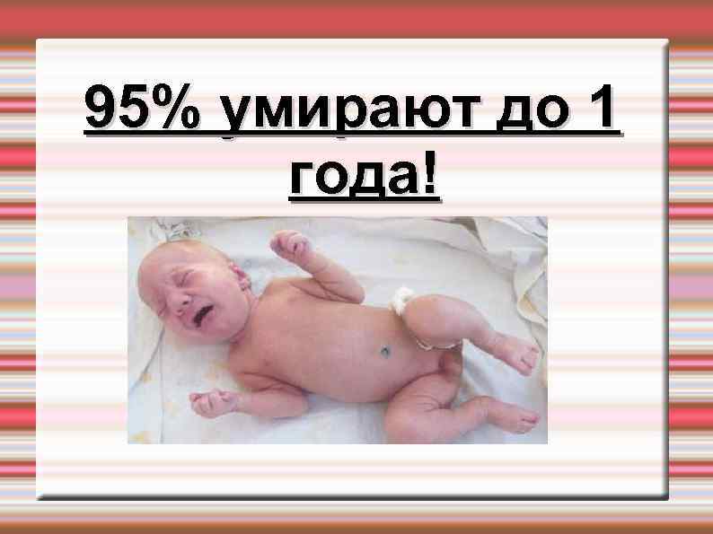 95% умирают до 1 года! 