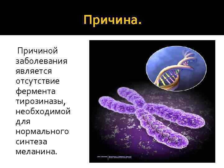 Причина. Причиной заболевания является отсутствие фермента тирозиназы, необходимой для нормального синтеза меланина. 