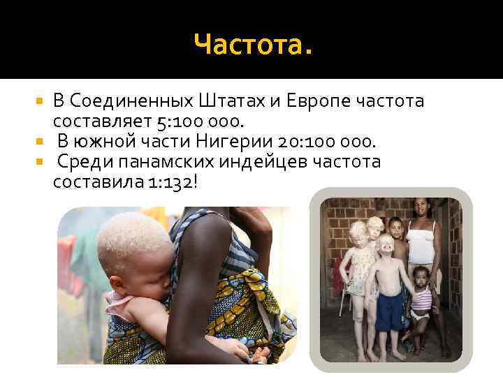 Частота. В Соединенных Штатах и Европе частота составляет 5: 100 000. В южной части