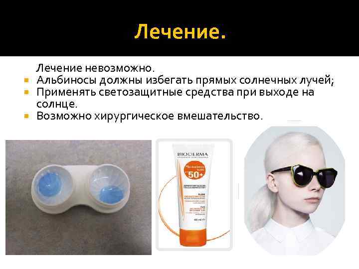 Лечение. Лечение невозможно. Альбиносы должны избегать прямых солнечных лучей; Применять светозащитные средства при выходе