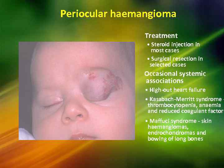 Periocular haemangioma Treatment • Steroid injection in most cases • Surgical resection in selected