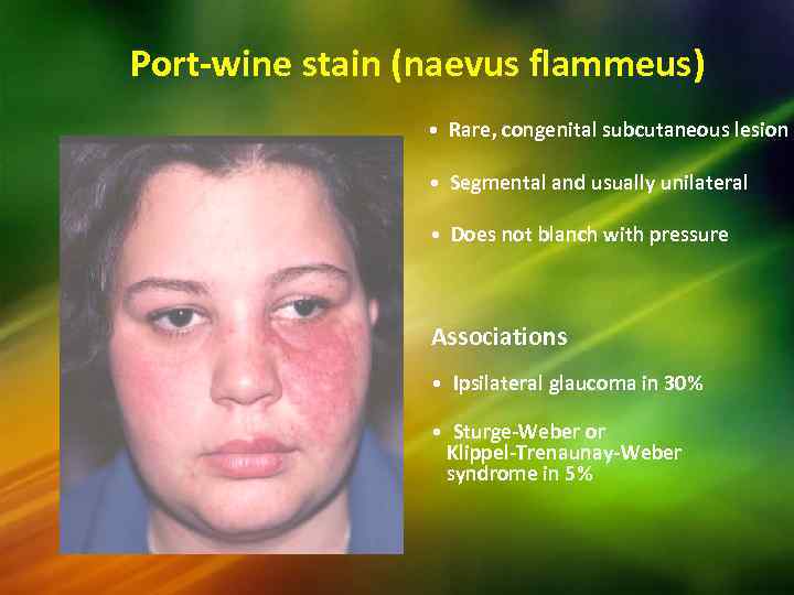 Port-wine stain (naevus flammeus) • Rare, congenital subcutaneous lesion • Segmental and usually unilateral