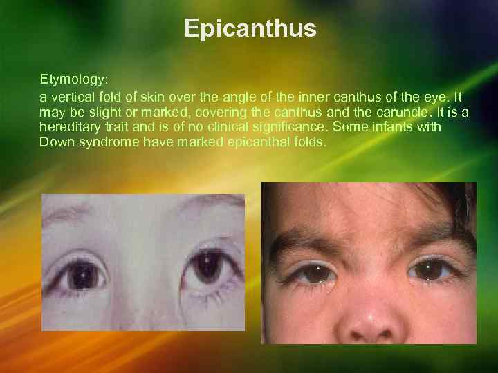 Epicanthus Etymology: a vertical fold of skin over the angle of the inner canthus