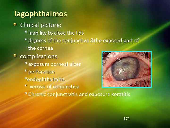 lagophthalmos Clinical picture: * inability to close the lids * dryness of the conjunctiva