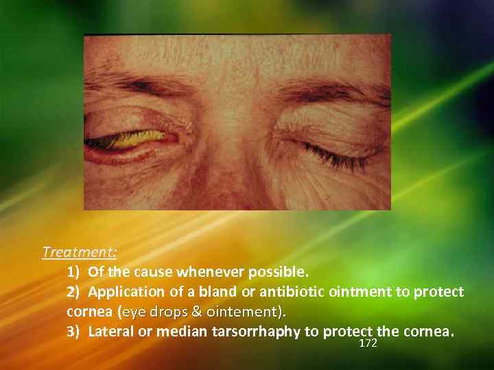 Treatment: 1) Of the cause whenever possible. 2) Application of a bland or antibiotic
