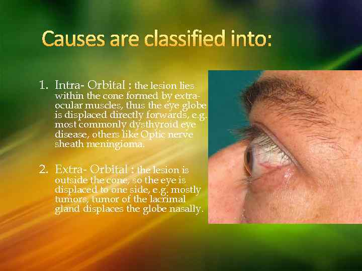 Causes are classified into: 1. Intra- Orbital : the lesion lies within the cone