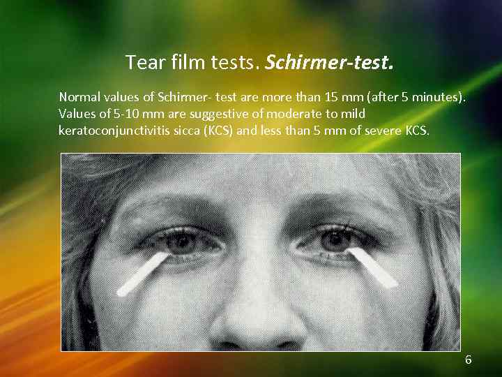 Tear film tests. Schirmer-test. Normal values of Schirmer- test are more than 15 mm