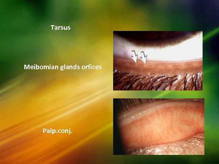 Tarsus Meibomian glands orfices Palp. conj. 