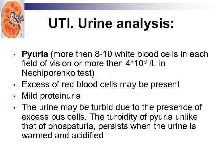 UTI. Urine analysis: • • Pyuria (more then 8 -10 white blood cells in