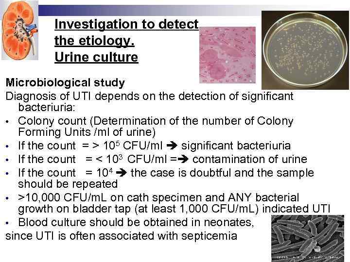 Investigation to detect the etiology. Urine culture Microbiological study Diagnosis of UTI depends on