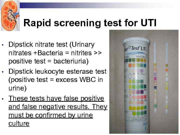 Rapid screening test for UTI • • • Dipstick nitrate test (Urinary nitrates +Bacteria