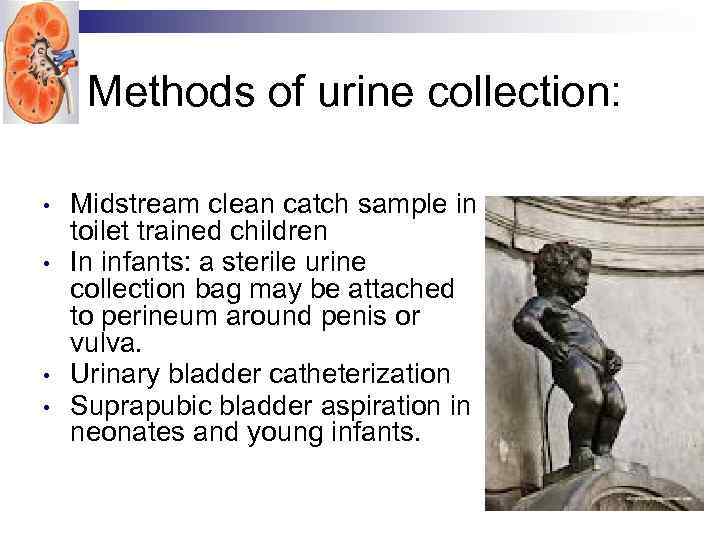 Methods of urine collection: • • Midstream clean catch sample in toilet trained children