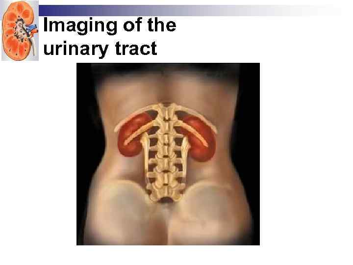 Imaging of the urinary tract 