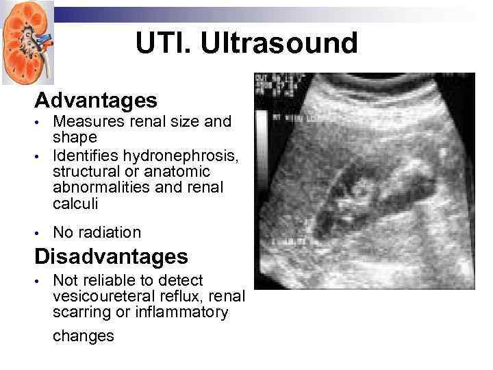 UTI. Ultrasound Advantages • Measures renal size and shape Identifies hydronephrosis, structural or anatomic