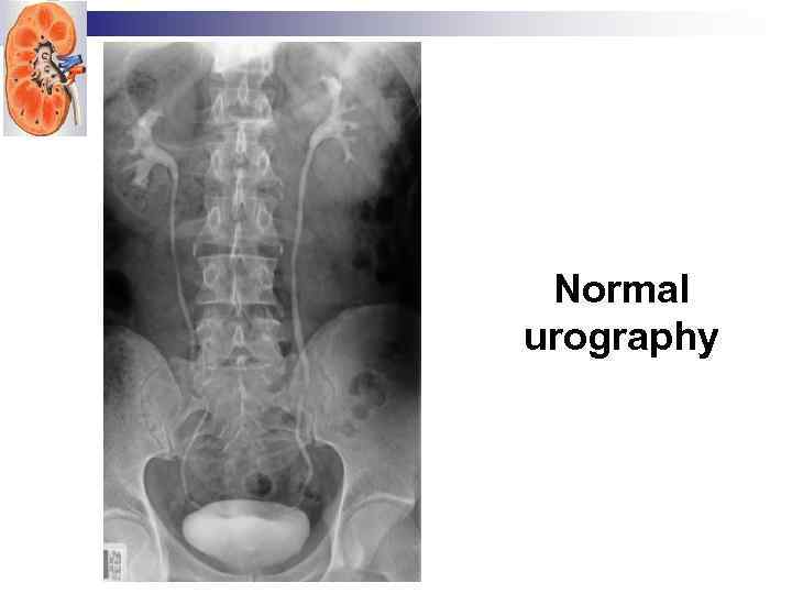 Normal urography 