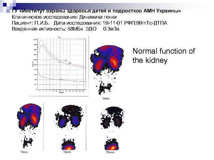 ГУ «Институт охраны здоровья детей и подростков АМН Украины» Клиническое исследование: Динамика почки Пациент: