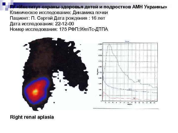 ГУ «Институт охраны здоровья детей и подростков АМН Украины» Клиническое исследование: Динамика почки Пациент: