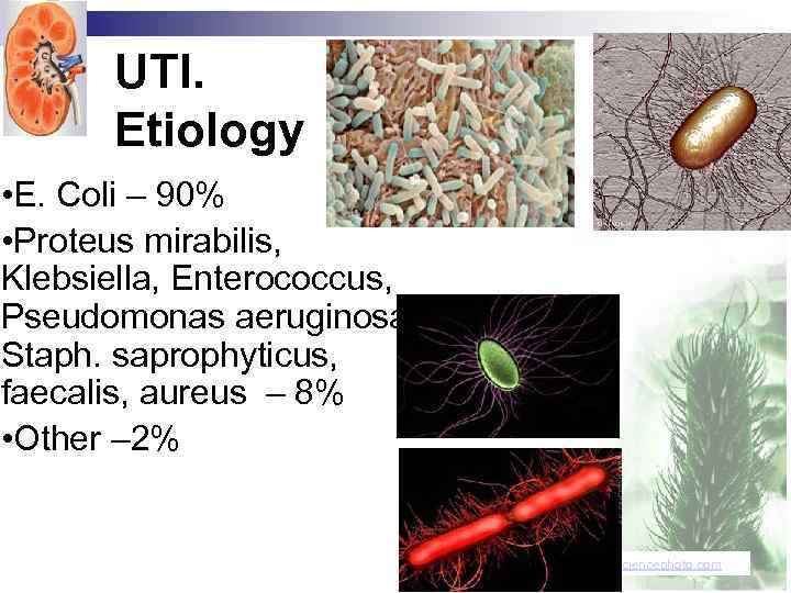 UTI. Etiology • E. Coli – 90% • Proteus mirabilis, Klebsiella, Enterococcus, Pseudomonas aeruginosa,