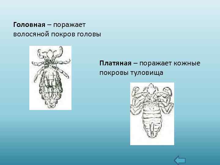 Головная – поражает волосяной покров головы Платяная – поражает кожные покровы туловища 