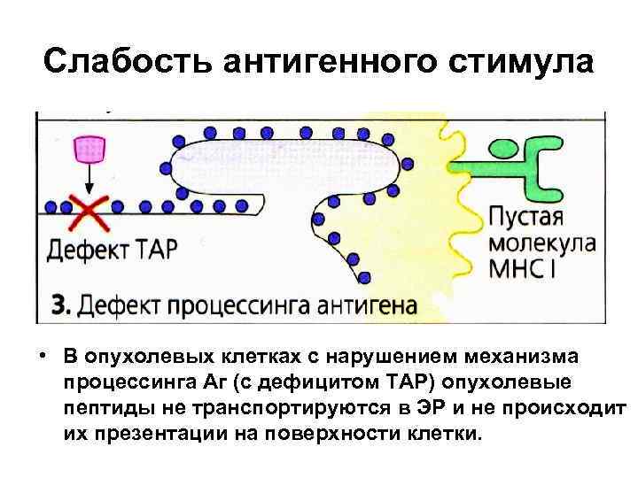 Слабость антигенного стимула • В опухолевых клетках с нарушением механизма процессинга Аг (с дефицитом
