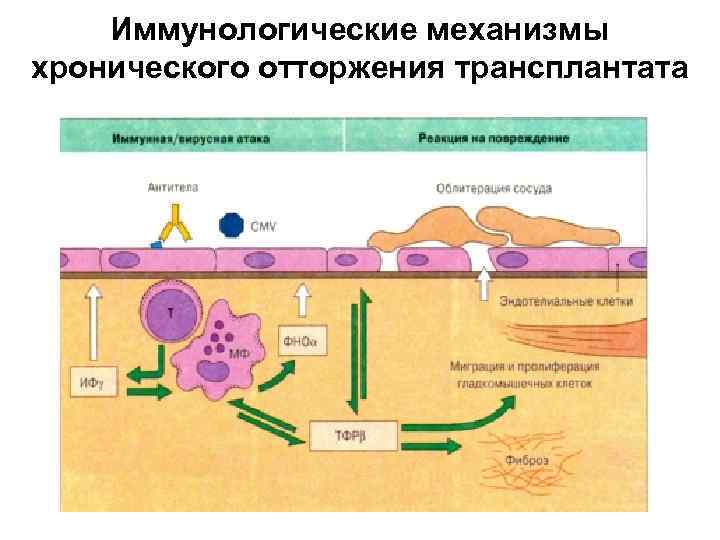 Иммунологические механизмы хронического отторжения трансплантата 