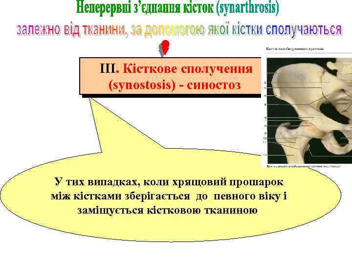 ІІІ. Кісткове сполучення (synostosis) - синостоз У тих випадках, коли хрящовий прошарок між кістками