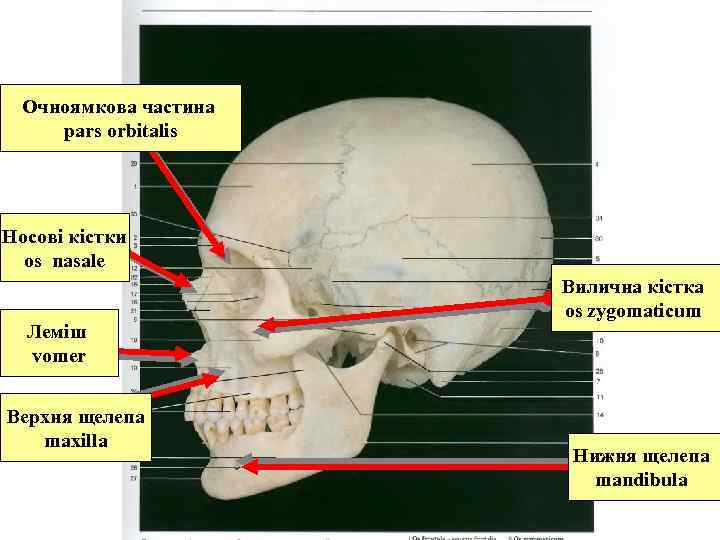 Oчноямкова частина pars orbitalis Носові кістки os nasale Леміш vomer Верхня щелепа maxilla Вилична