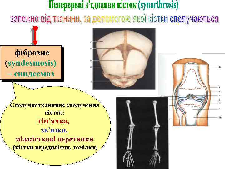 фіброзне (syndesmosis) – синдесмоз Сполучнотканинне сполучення кісток: тім'ячка, зв'язки, міжкісткові перетинки (кістки передпліччя, гомілки)