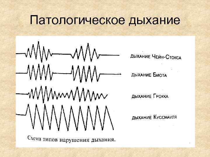 Нормальное дыхание схема