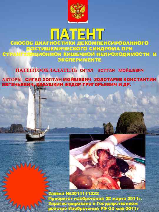 ПАТЕНТ СПОСОБ ДИАГНОСТИКИ ДЕКОМПЕНСИРОВАННОГО ПОСТИШЕМИЧЕСКОГО СИНДРОМА ПРИ СТРАНГУЛЯЦИОННОЙ КИШЕЧНОЙ НЕПРОХОДИМОСТИ В ЭКСПЕРИМЕНТЕ ПАТЕНТООБЛАДАТЕЛЬ СИГАЛ