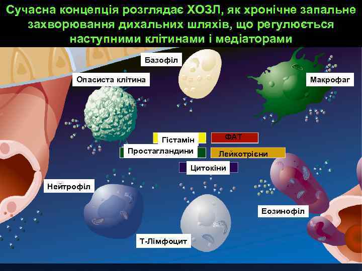 Сучасна концепція розглядає ХОЗЛ, як хронічне запальне захворювання дихальних шляхів, що регулюється наступними клітинами