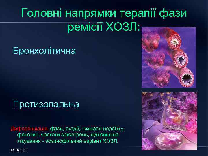 Головні напрямки терапії фази ремісії ХОЗЛ: Бронхолітична Протизапальна Диференціація: фази, стадії, тяжкості перебігу, фенотип,