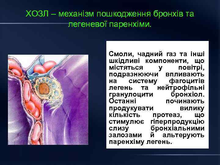 ХОЗЛ – механізм пошкодження бронхів та легеневої паренхіми. Смоли, чадний газ та інші шкідливі