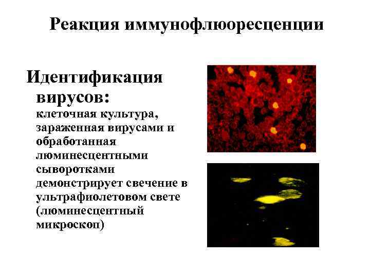 Реакция иммунофлюоресценции Идентификация вирусов: клеточная культура, зараженная вирусами и обработанная люминесцентными сыворотками демонстрирует свечение