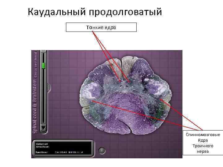 Каудальный продолговатый Тонкие ядра Спинномозговые Ядра Троичного нерва 