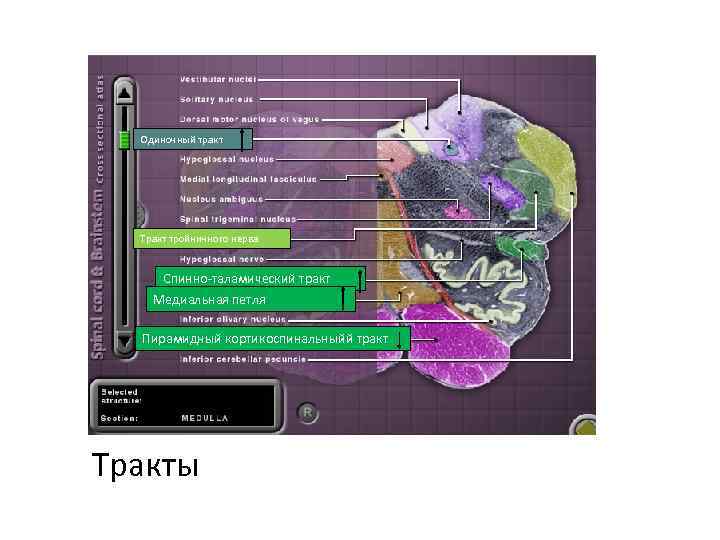 Одиночный тракт Тракт тройничного нерва Спинно-таламический тракт Медиальная петля Пирамидный кортикоспинальныйй тракт Тракты 