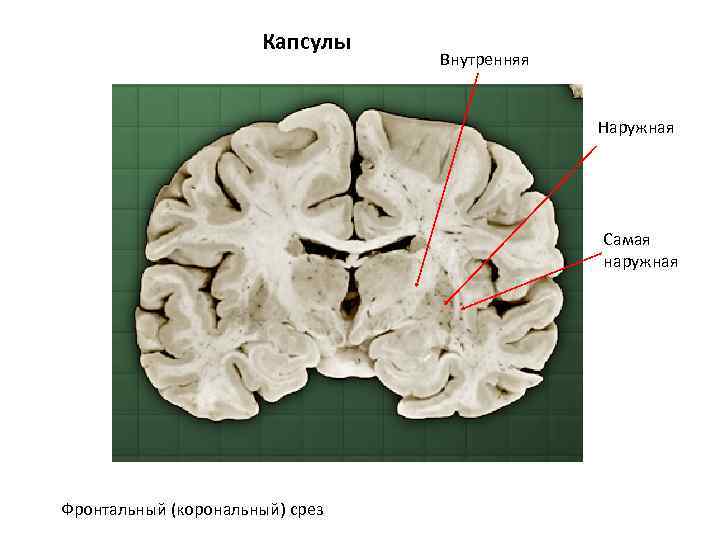 Капсулы Внутренняя Наружная Самая наружная Фронтальный (корональный) срез 