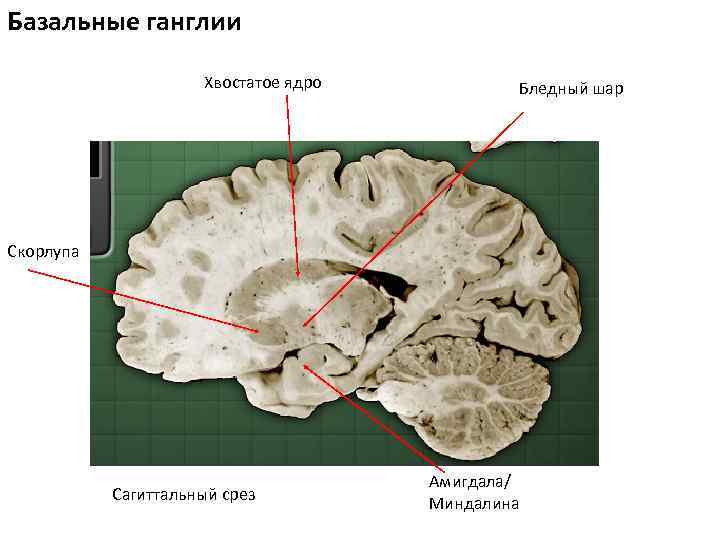 Базальные ганглии Хвостатое ядро Бледный шар Скорлупа Сагиттальный срез Амигдала/ Миндалина 