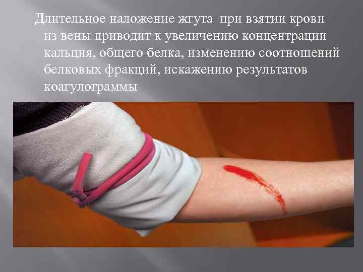 Длительное наложение жгута при взятии крови из вены приводит к увеличению концентрации кальция, общего