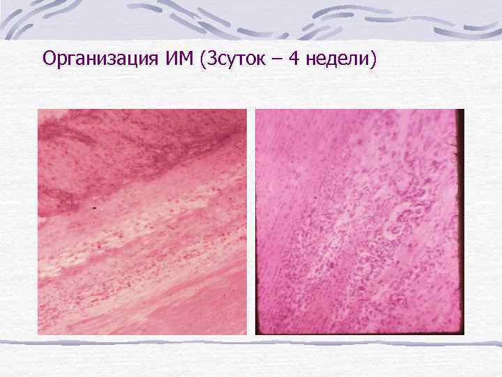 Организация ИМ (3 суток – 4 недели) 