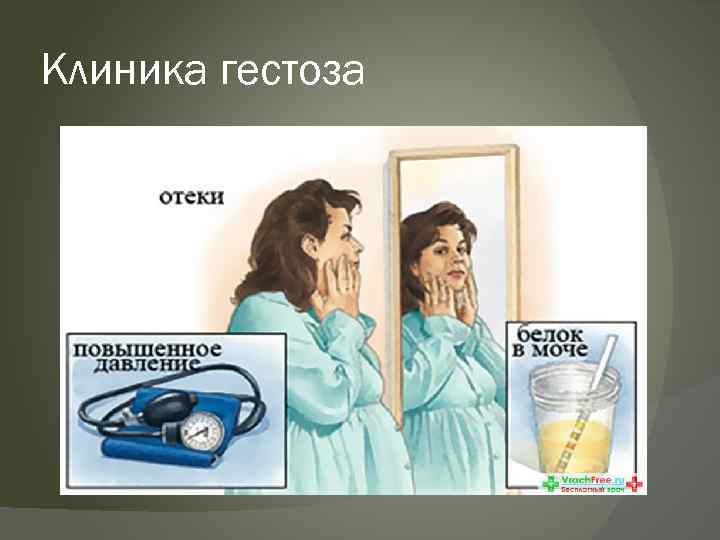 Клиника гестоза 